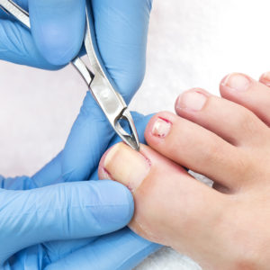 What is a podiatrist?