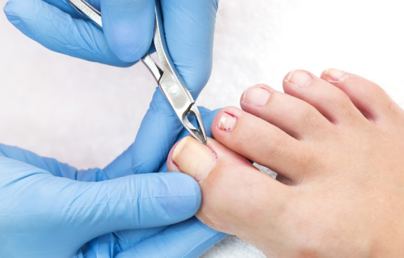 What is a podiatrist?