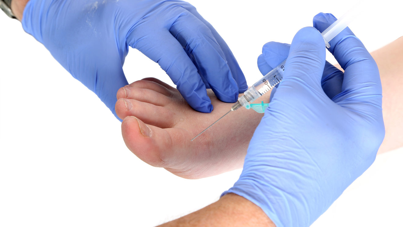 Prolotherapy for the lower limb Morecroft's Podiatry Services, Lilydale